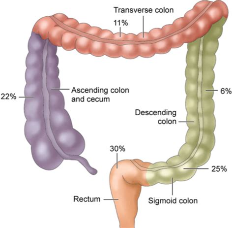 Colorectal Cancer Crc Flashcards Quizlet