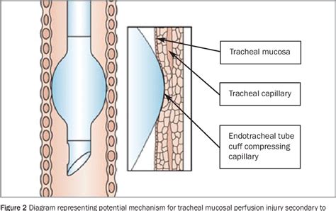 Endotracheal Intubation Dog Diagram