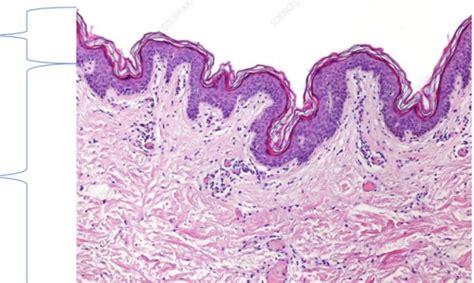 Anatomy Lecture Skin Histo And Flashcards Quizlet