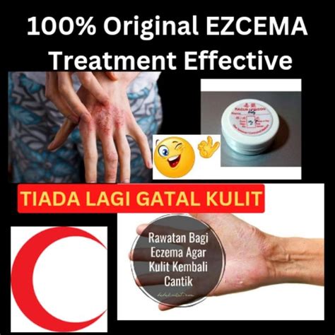 5g Eczema Cream Psoriasis Ubat Gatal Kulit Kudis Buta SCABIES Kuman