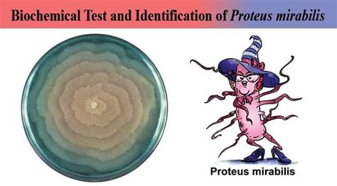 Biochemical Test And Identification Of Proteus Mirabilis Proteus