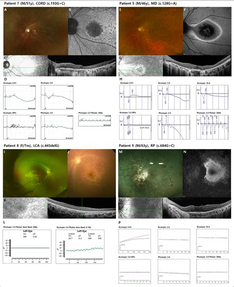 Color Fundus Photography Optical Coherence Tomography Oct Fundus