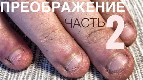 Ногти грызуна/ трапециевидные ногти/ преображение/обкусанные ногти ...