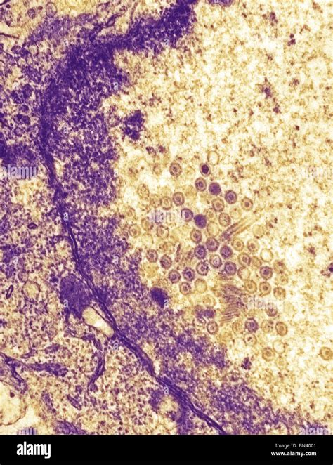 Negatively Stained Transmission Electron Micrograph Tem Of Numerous