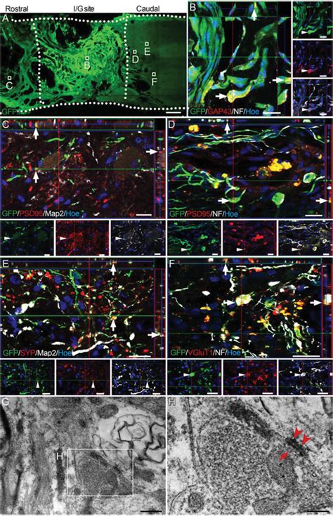 Donor Cells In Grafted Nn Tissue Maintain A Neuronal Phenotype And