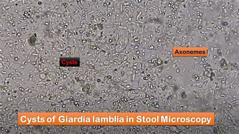 Giardia Cysts In Stool Microscopy Youtube