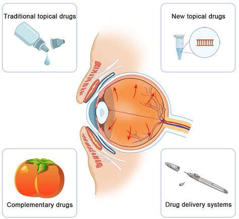 Current Situation And Progress Of Drugs For Reducing Intraocular