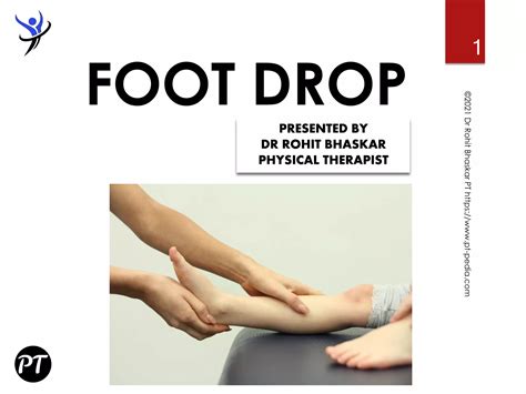 Foot Drop Causes Symptoms And Treatment Dr Rohit Bhaskar Ppt Free Download