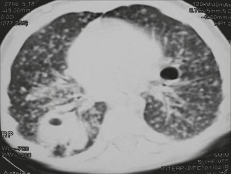 Scielo Brasil Radiological Aspects In Computed Tomography As