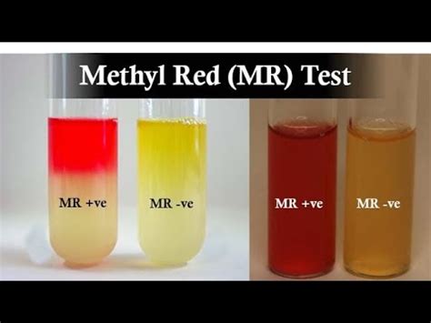 Methyl Red Test A Biochemical Test For Differentiation Of Mixed Acid