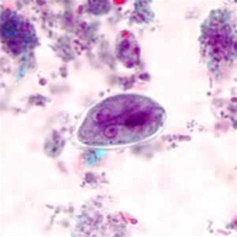 Giardia Ova