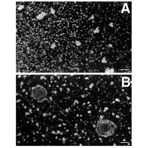 Effect Of GDF 5 On Cell Aggregation Phase Contrast Photographs Of A