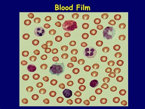 PPT - Blood Film PowerPoint Presentation, free download - ID:5376147