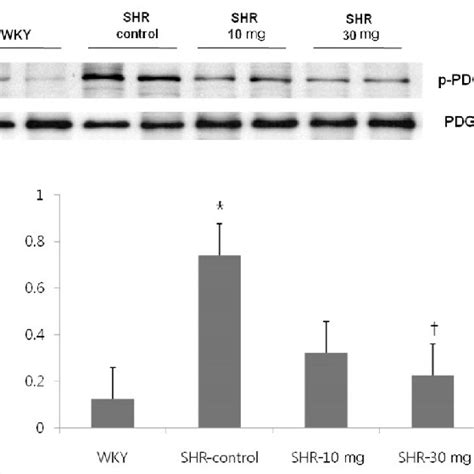 The Effect Of Imatinib Treatment On Tyrosine Phosphorylation Level Of