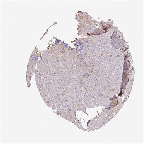 Tissue Expression Of Alb Staining In Liver The Human Protein Atlas