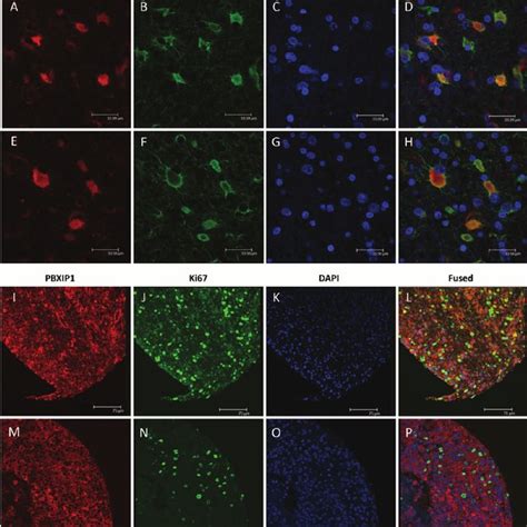 Immunofluorescence Microscopy On Paraffin Embedded Sections Of WHO