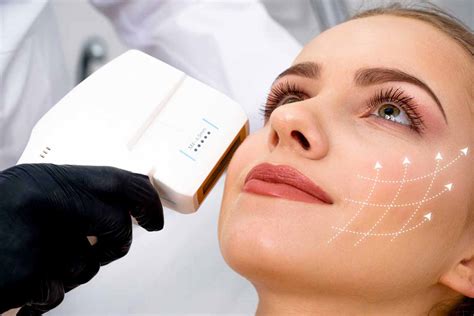 Lifting Facial con HIFU 4 D Dermax Dr Günther Rochefort Ciscutti