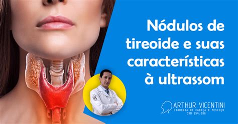 Nódulos De Tireoide E Suas Características à Ultrassom Dr Arthur