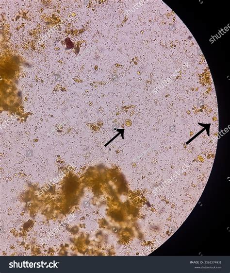 Blastocystis Hominis Histology