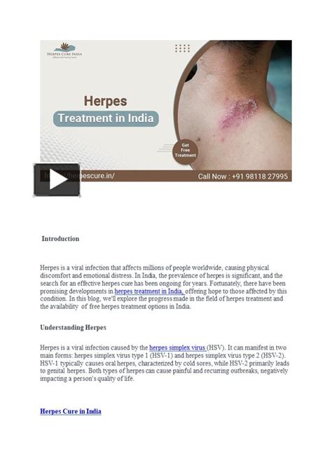 Ppt Treatment Of Herpes In India Powerpoint Presentation Free To