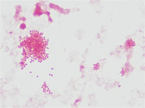 Neisseria Meningitidis Gram Stain