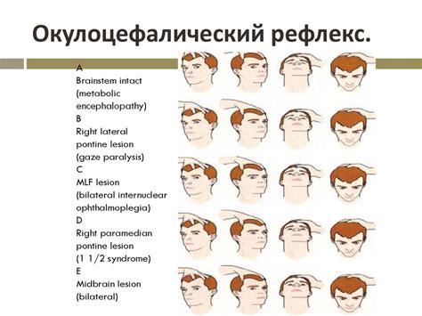Особенности неврологического осмотра в сосудистой нейрореанимации ...