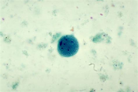 Lebenszyklus Von Entamoeba Coli