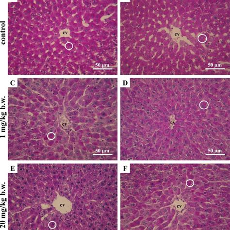 Micrographs of rat liver after PAS-staining. Differences in the numbers... | Download Scientific ...