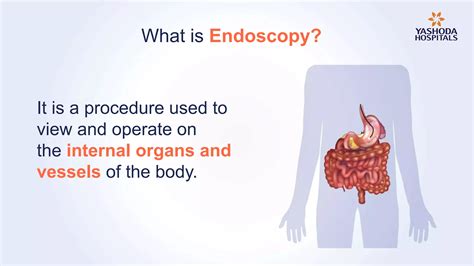 Endoscopy Types Preparation Diagnosis Procedure And Risks Ppt