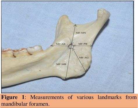 Figure 1 From An Anatomical Study And Clinical Correlations Of