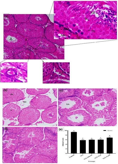 Testis Tissues In The Four Groups Were Analyzed Using The Hematoxylin