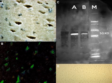 Lipid Peroxidation And Apoptotic Response In Rat Brain Areas Induced By