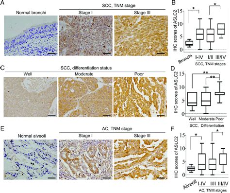 Ascl Expression Levels In Squamous Cell Carcinoma Scc And