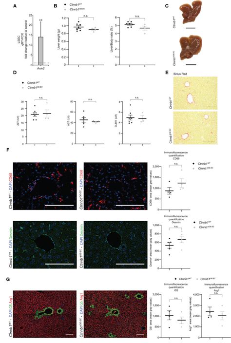 Imbalanced Activation of Wnt β Catenin Signaling in Liver Endothelium