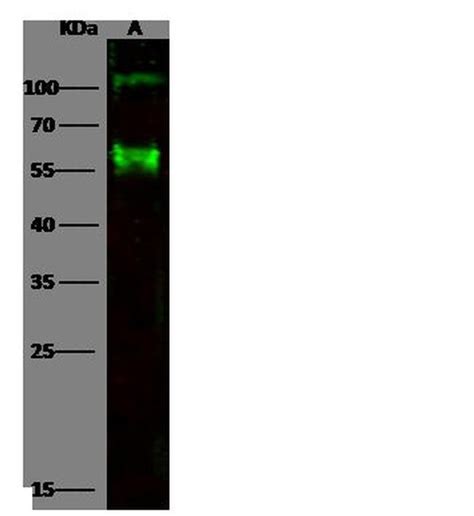 CD30 Antibody (PA5-81083)