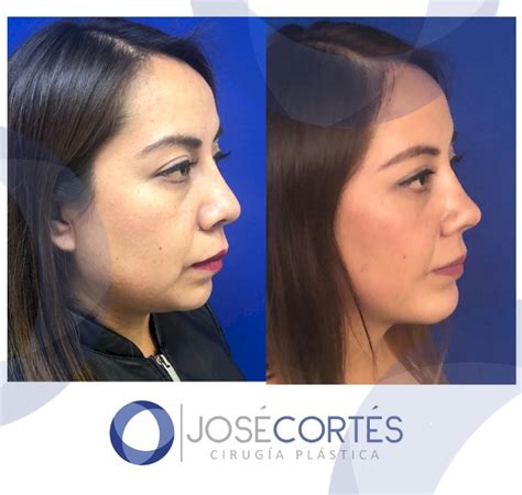 38 Best Plastic Surgery Clinics In Mexico Price‎s Doctors And Reviews