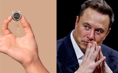 Neuralink De Elon Musk Implanta Primer Chip En Cerebro De Un Humano