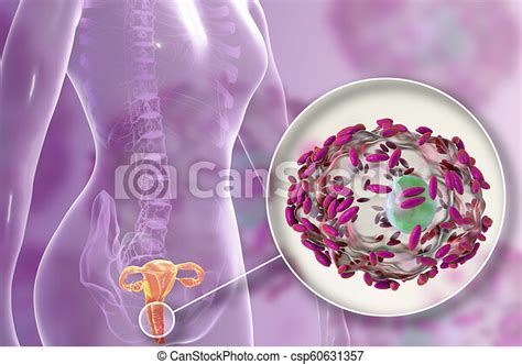 Bacterial Vaginosis Bacteria Gardnerella Vaginalis Bacterial Vaginosis Vaginal Secretions