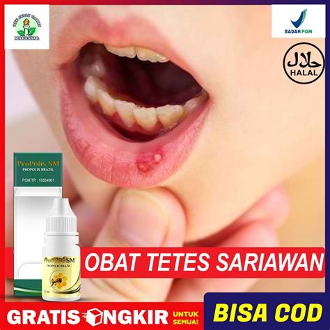 Jual Obat Tetes Sariawan Oles Sariawan Penghilang Bau Mulut Menahun