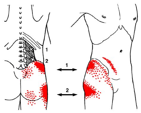 Myofascial Trigger Point Therapy Massage Santa Barbara Goleta Ca