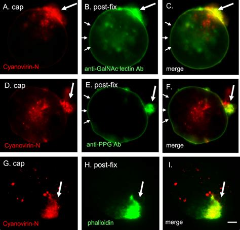 Cyanovirin N Cocaps And Partially Depletes The Gal Galnac Lectin And