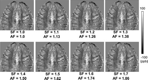 Frontiers Feasibility Of Ultrashort Echo Time Quantitative