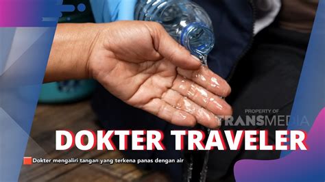 Cara Mengobati Tangan Yang Terkena Panas Dokter Traveler P