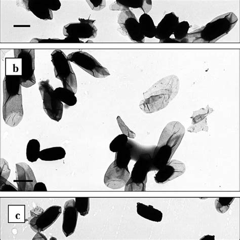 Transmission Electron Microscopy Of Negatively Stained B Cereus Spores