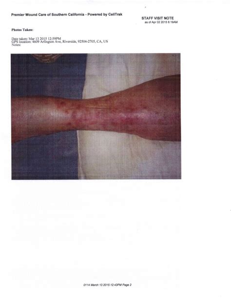 Before And After Photos Premier Wound Care