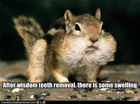 25 Wisdom Teeth Memes That Are Too Funny For Words - SayingImages.com