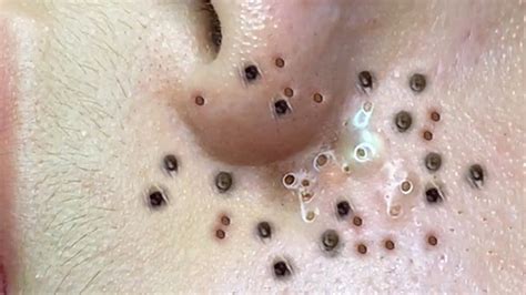 𝐀 𝐖𝐨𝐧𝐝𝐞𝐫𝐟𝐮𝐥 𝐃𝐚𝐲 # 3557 - YouTube 