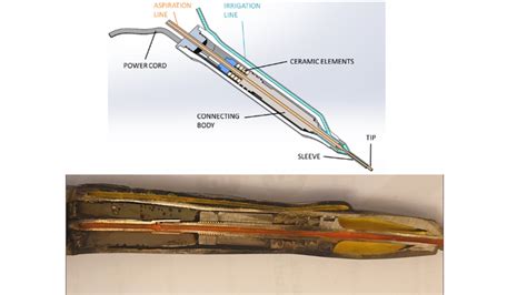 Phacoemulsification Handpieces First Point Decon