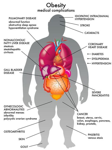 Obesity, Cancer: Evidence Grows Supporting the Link