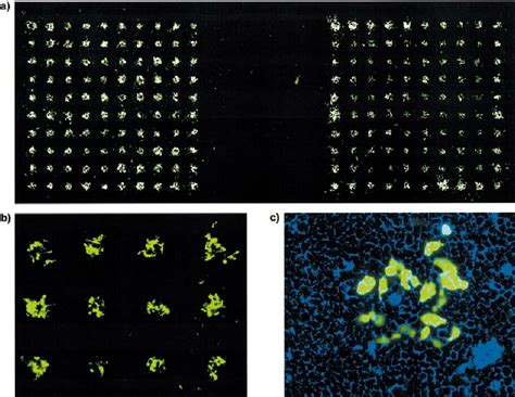 Fluorescence Of Hek293t Cells Transfected With An Egfp Coding Plasmid